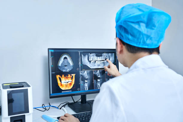 Best Emergency Dentist for Lost Fillings or Crowns in Leominster, MA