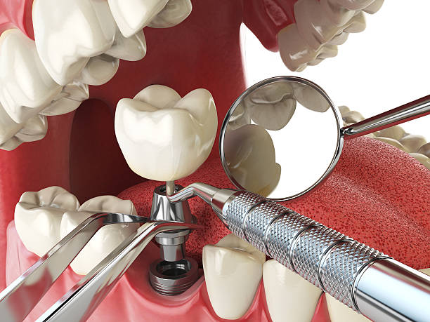 Best Emergency Dental Services for Seniors in Leominster, MA
